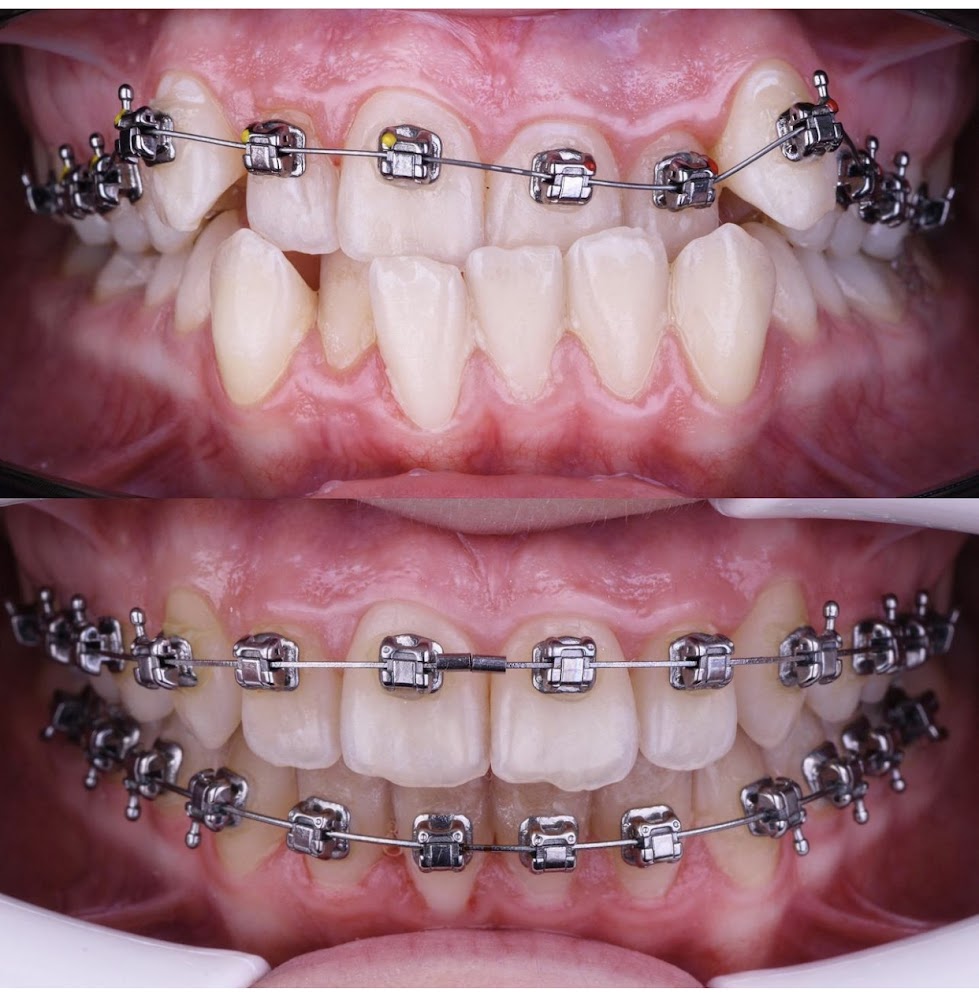 The Smile Restore Dental Clinics (East Legon Branch)