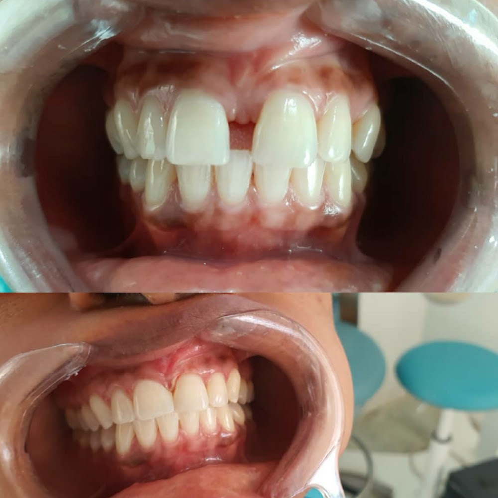 Zoe Premium Dental Centre