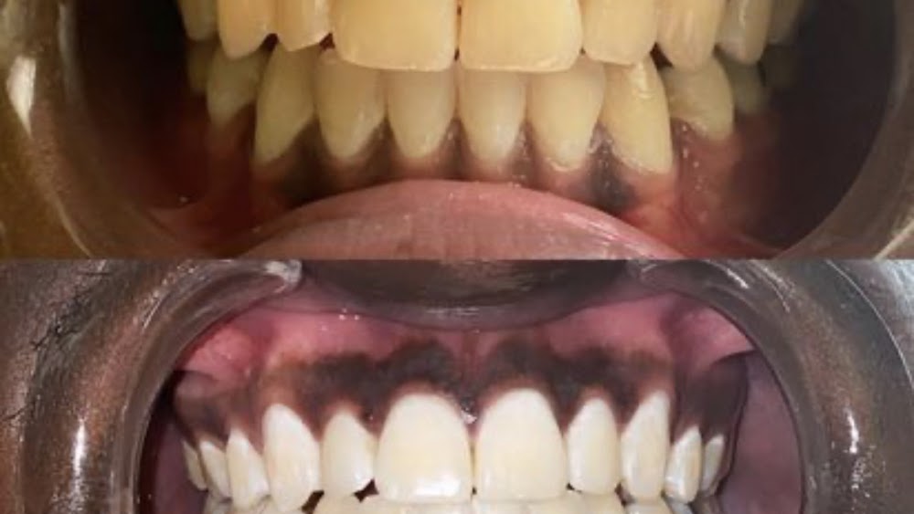 Smile Restore Dental Clinics (Labone)