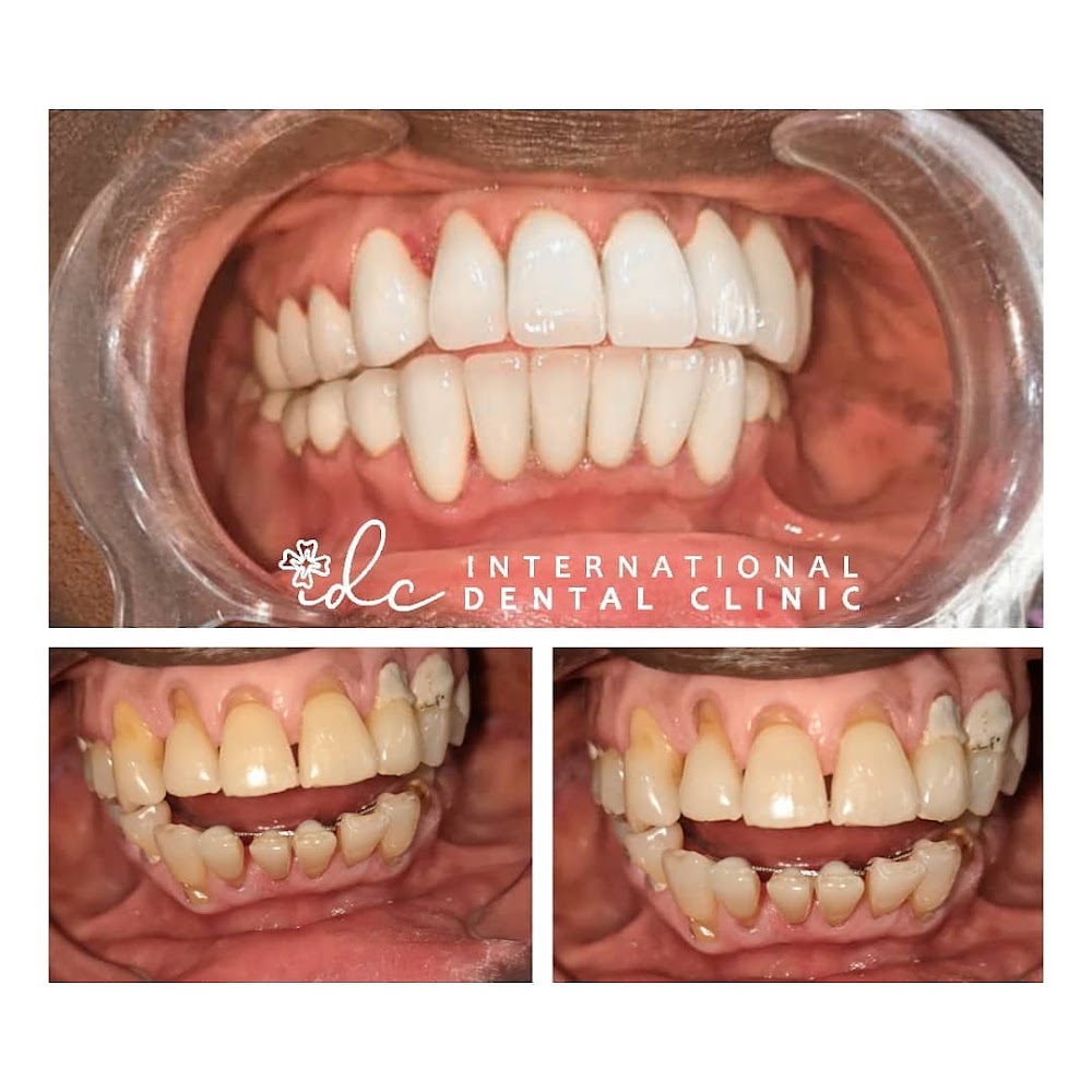 International Dental Clinic Ghana