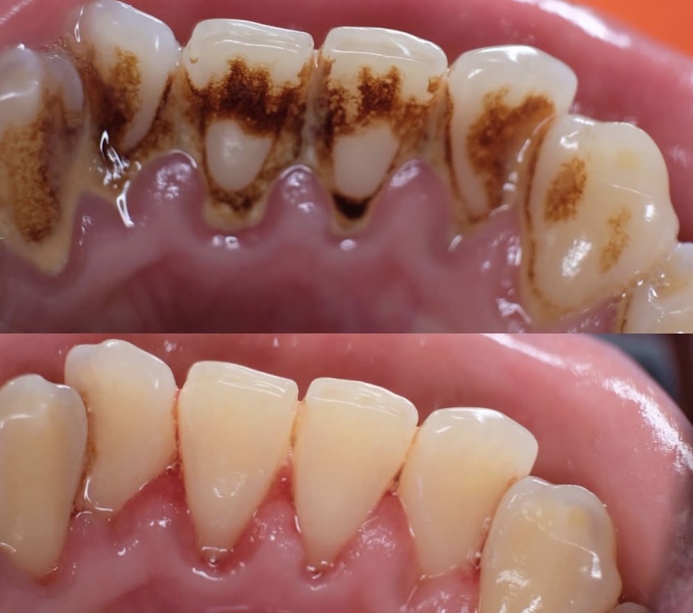 DEL Dental & Implant Clinic